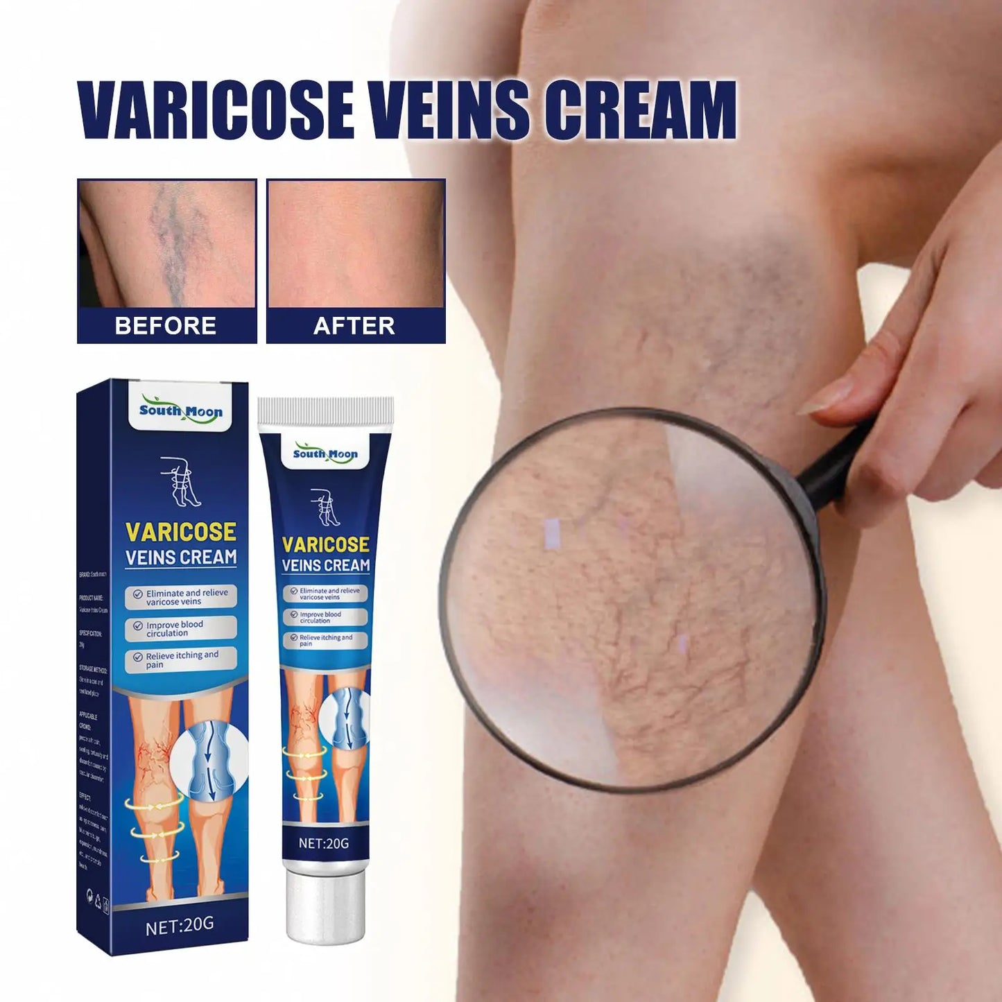 South Moon Varicose Veins Cream