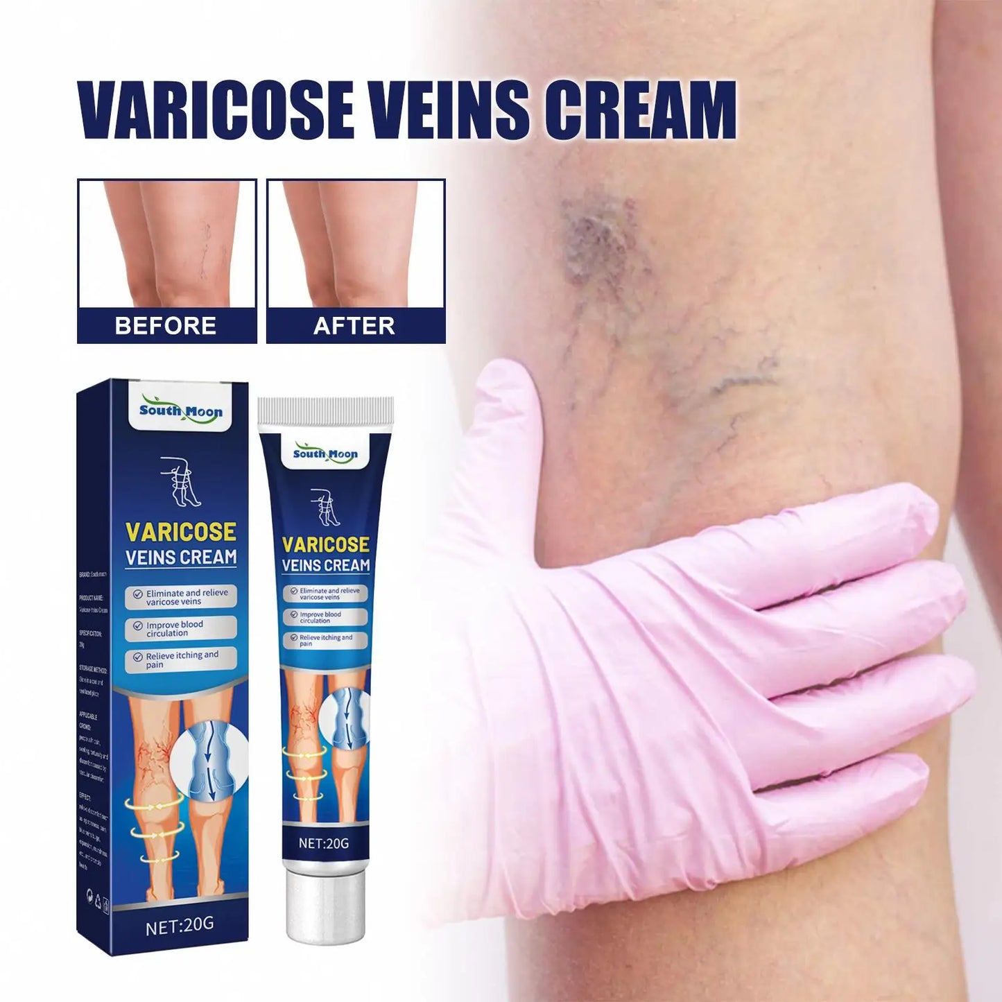 South Moon Varicose Veins Cream