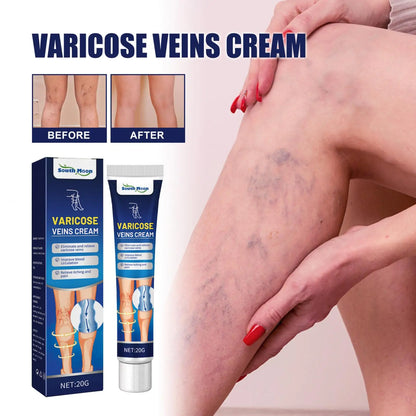 South Moon Varicose Veins Cream