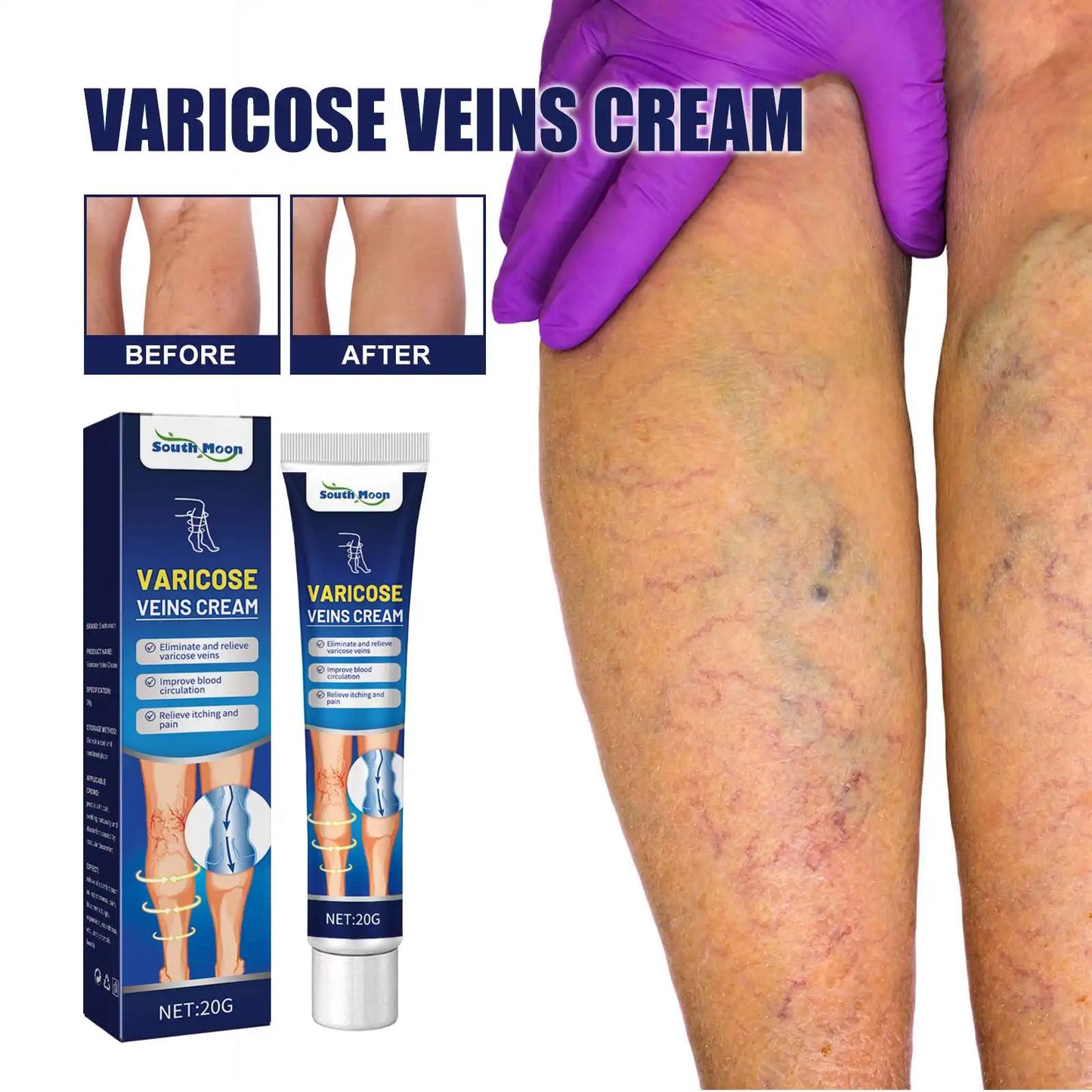 South Moon Varicose Veins Cream