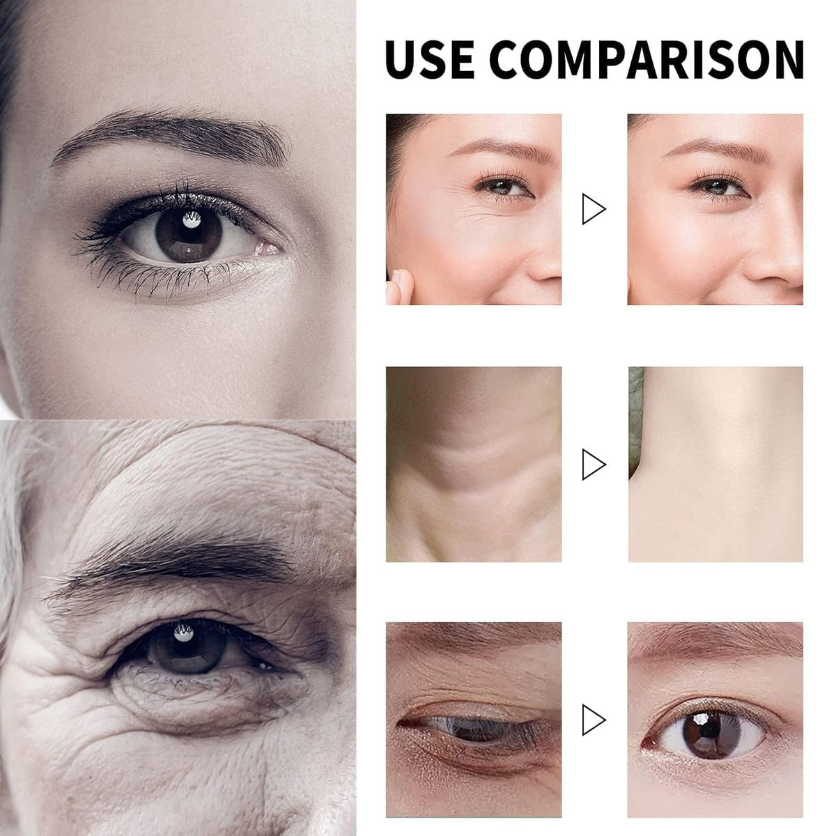 Qingling Anti-Wrinkle Face Cream