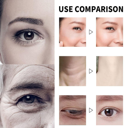 Qingling Anti-Wrinkle Face Cream